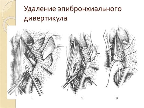 Синдром дисфагии - презентация онлайн