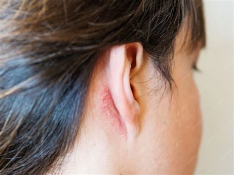 Premium Photo | Irritation on the skin behind the ear. Man with flaky