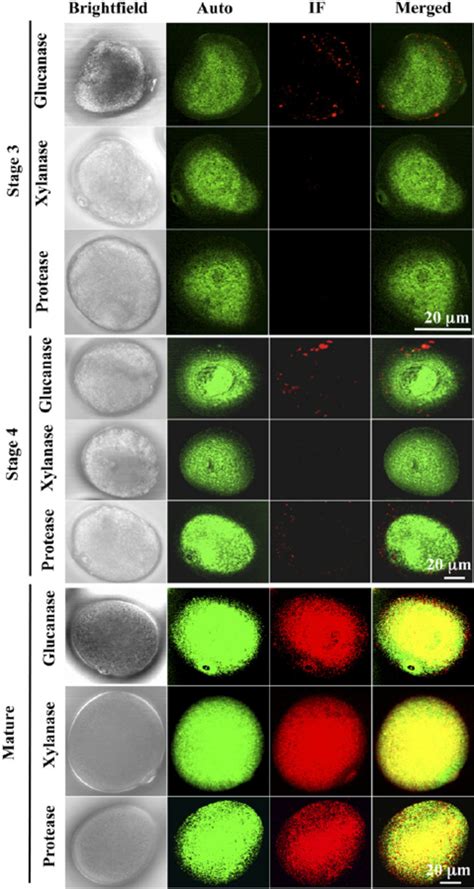 Bright-field, autofluorescence, and immunofluorescence (IF) microscopy ...