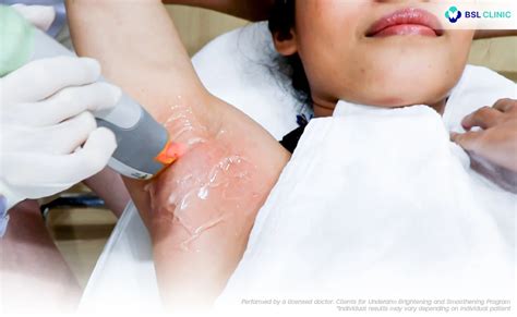 how to remove underarm hair