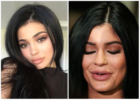Before-and-After: Celebrity Plastic Surgery Images That Will Make Your ...