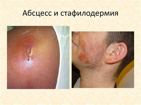 Структура бактериальной клетки. Форма бактерий - презентация онлайн