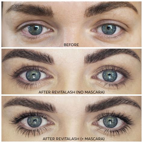 Revitalash Advanced Lash Growth Serum : Full Review with Before and