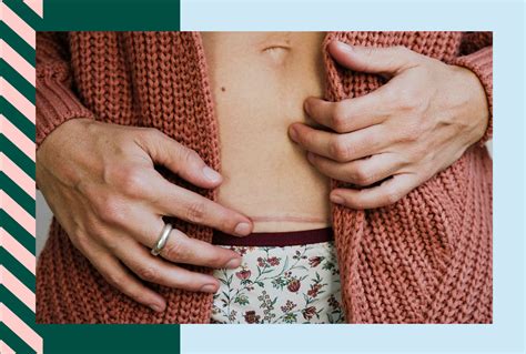 Recovering From a C-Section: What to Expect Each Week