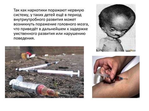Вредное влияние алкоголя, курения и наркотиков в период эмбрионального ...
