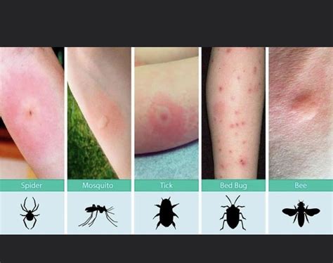 Pin by Michele Metz on Gardening | Identifying bug bites, Useful life ...