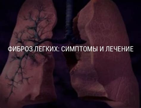 Фиброз легких: что это такое и как лечить, симптомы фиброза легких и ...