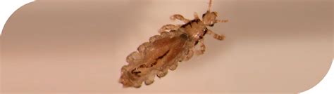 liceworld       head lice
