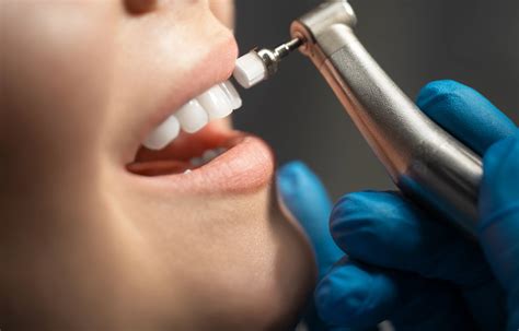Teeth Cleaning, Scaling & Polishing in Dubai, UAE | Skin111