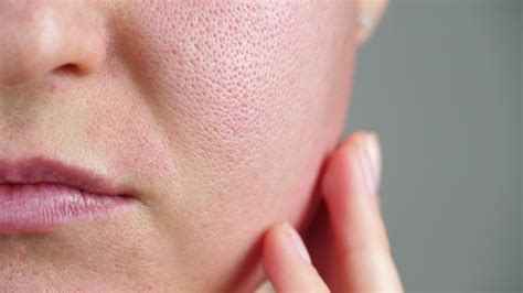 how to fix your skin barrier