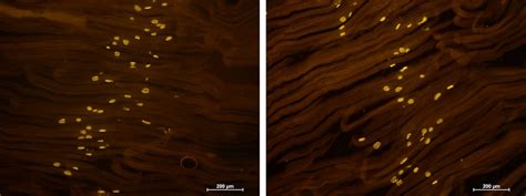 Bungaro-toxin marker for histology - pathologica