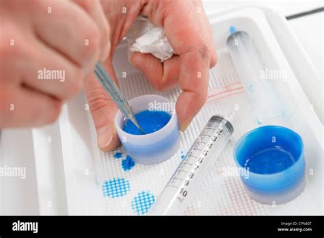 OCULAR IMPLANT Stock Photo, Royalty Free Image: 48408888 - Alamy