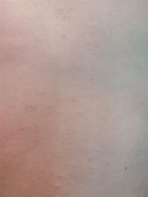 son complaining  small itchy spots rmedical