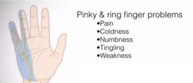 How to treat pain, cold, numbness in the pinky and ring finger - ulnar ...