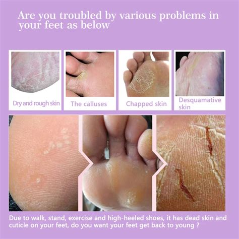 Exfoliating Foot Mask Pedicure Socks – Stiylo