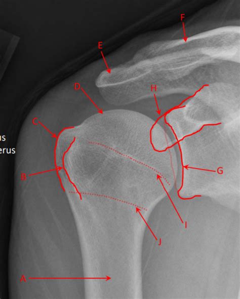 shoulder ap diagram quizlet