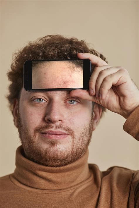Forehead Acne Photos, Download The BEST Free Forehead Acne Stock Photos ...