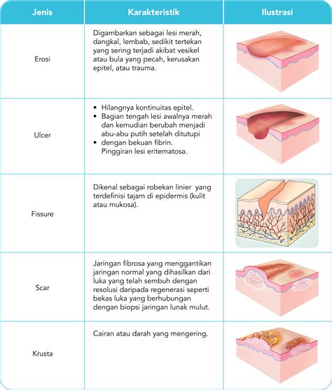 Lesi Sekunder