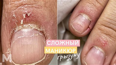 КРОВАВЫЕ заусенцы и ЖЕСТКАЯ НАЛИПШАЯ кутикула 🍖 Маникюр ГРЫЗУНУ ...