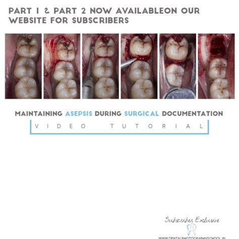 Maintaining asepsis during surgical documentation