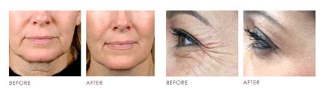 How to Choose a Suitable Dr & Clinic for Aesthetic Procedure
