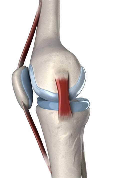 medial collateral ligament injury   knee xoxuf