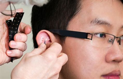 Ear Magnet Therapy For Weight Loss - WeightLossLook