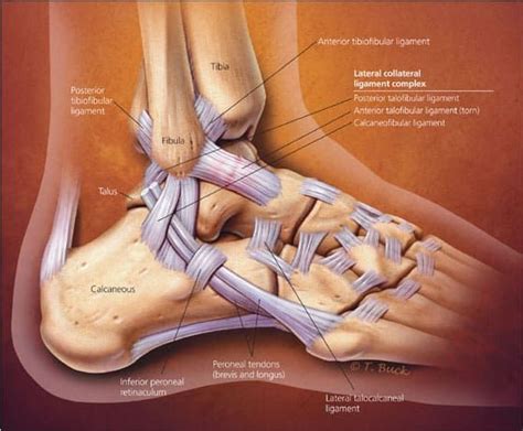ankle sprain instability dr mike smith orthopaedic surgeon