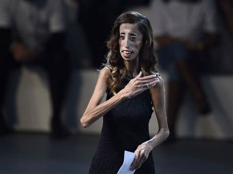 Lizzie Velasquez: How the activist named 'world's ugliest woman