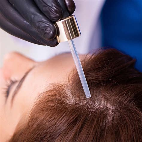 hair loss alpha asia aesthetics