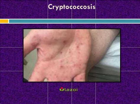 cryptococcosis cats 1