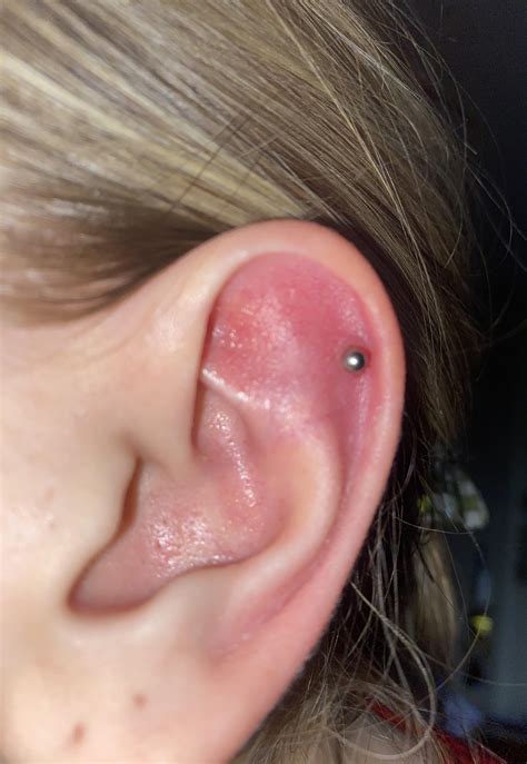 Irritation bump, improper jewelry, infection in my helix? : r/piercing