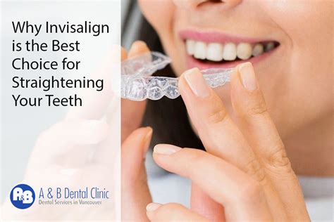 Why Invisalign is the Best Choice for Straightening Your Teeth - AB ...