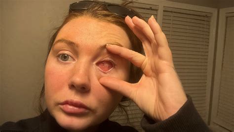 The Public Didn't See This: Aubrey Keys' Private Recovery Journey Image 18