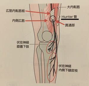 伏在神経由来の疼痛「ハンター管症候群」とは？原因や症状、治療法とは？