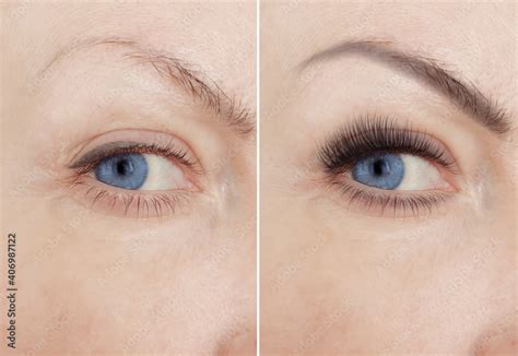 girl eyes eyelashes before and after Stock Photo | Adobe Stock