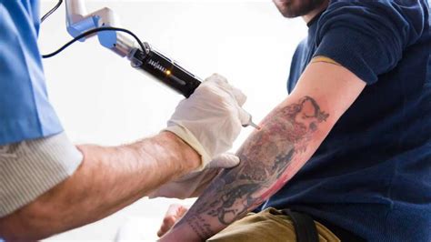 tattoo removal laser treatment clear skin pune