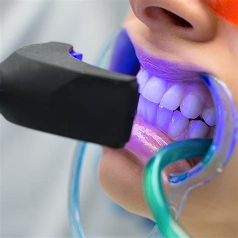 teeth whitening bleaching dr  clinic istanbul