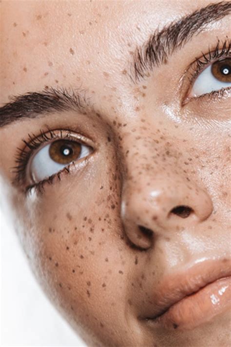 freckle tattoos         inked