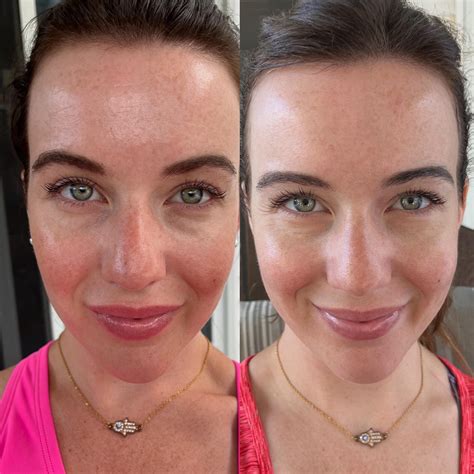 Rosealine Dawnxs: Before & After  The Results Are ASTOUNDING! Image 18