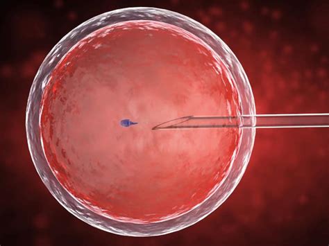 multiple miscarriages high risk obgyn dr steve rad