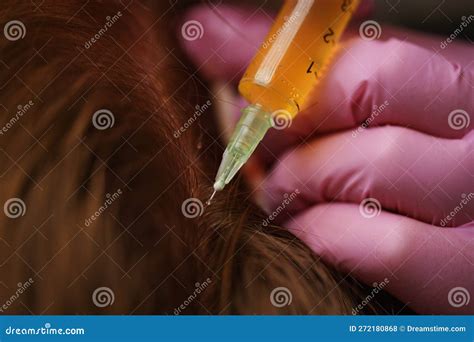 Injections of Blood Plasma in the Face and Head. Stock Photo - Image of ...