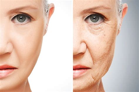 Ozempic® Face: What is it and how can you avoid it