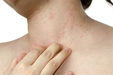 red itchy spots   time  visit  dermatologist womens magazine