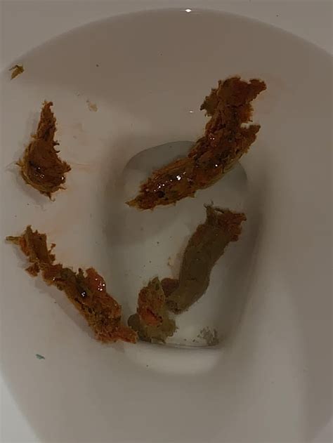 I’m petrified. I had flaming hot Cheetos a couple of times yesterday ...