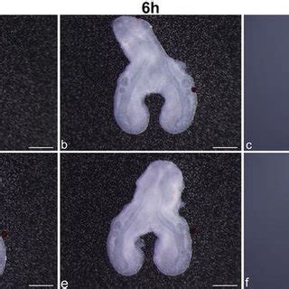 ptch1 expression pattern in early stages of chick lung development ... 