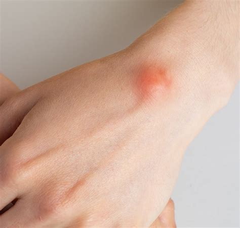 cosmetic medical dermatology serving dallas tx north dallas