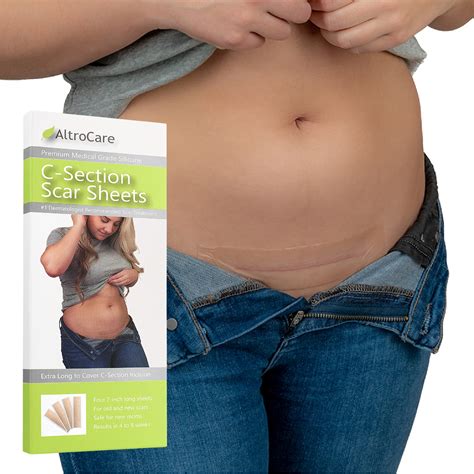 AltroCare Postpartum Silicone Scar Sheets for C-Section - 4-Pack of 7