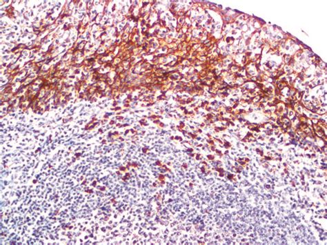CD138 Antibody (B-A38) - Bio SB
