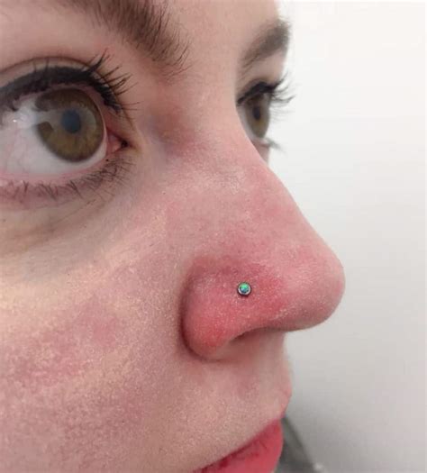 Nostril Piercing Infection
